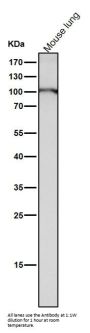 Anti-Dnmt3b Rabbit Monoclonal Antibody Rabbit Monoclonal Antibody