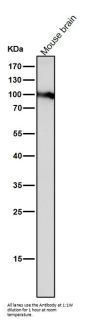 Anti-Dnmt3b Rabbit Monoclonal Antibody Rabbit Monoclonal Antibody