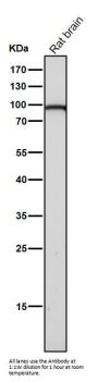 Anti-Dnmt3b Rabbit Monoclonal Antibody Rabbit Monoclonal Antibody