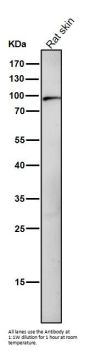 Anti-Dnmt3b Rabbit Monoclonal Antibody Rabbit Monoclonal Antibody