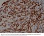 Anti-TPO (Thyroid Peroxidase) Rabbit Monoclonal Antibody, Clone#RM368