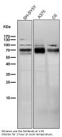 Anti-BACE1/Bace Rabbit Monoclonal Antibody