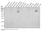 Anti-BACE1/Bace Rabbit Monoclonal Antibody