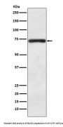 Anti-BACE1/Bace Rabbit Monoclonal Antibody