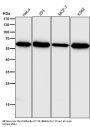 Anti-HDAC2/Histone Deacetylase 2 Rabbit Monoclonal Antibody