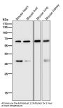 Anti-HDAC2/Histone Deacetylase 2 Rabbit Monoclonal Antibody