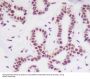 Anti-HDAC2/Histone Deacetylase 2 Rabbit Monoclonal Antibody