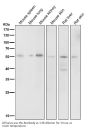 Anti-HDAC2/Histone Deacetylase 2 Rabbit Monoclonal Antibody