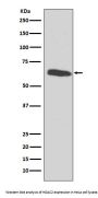 Anti-HDAC2/Histone Deacetylase 2 Rabbit Monoclonal Antibody