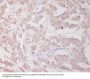 Anti-Beclin 1 BECN1 Monoclonal Antibody