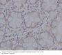 Anti-pro Caspase 3 CASP3 Rabbit Monoclonal Antibody