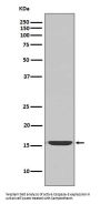 Anti-active Caspase-3 CASP3 Rabbit Monoclonal Antibody