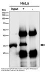 Anti-Caspase-3 CASP3 Rabbit Monoclonal Antibody