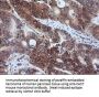 Anti-Calpastatin (CAST) Mouse Monoclonal Antibody [Clone ID: OTI1E7]