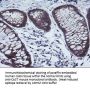 Anti-Calpastatin (CAST) Mouse Monoclonal Antibody [Clone ID: OTI1E7]