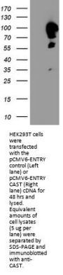 Anti-Calpastatin (CAST) Mouse Monoclonal Antibody [Clone ID: OTI1E7]