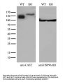 Anti-Calpastatin (CAST) Mouse Monoclonal Antibody [Clone ID: OTI1E7]
