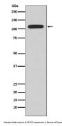 Anti-NFAT2 NFATC1 Rabbit Monoclonal Antibody