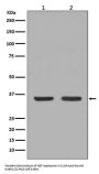Anti-NGF/Beta Ngf Rabbit Monoclonal Antibody