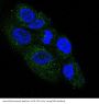 Anti-NGF/Beta Ngf Rabbit Monoclonal Antibody