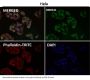 Anti-NGF/Beta Ngf Rabbit Monoclonal Antibody