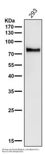 Anti-ATG7/Apg7 Rabbit Monoclonal Antibody