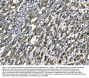 Anti-SOD2 Antibody Picoband® (monoclonal, 2B12B1)