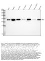 Anti-SOD2/Mnsod Rabbit Monoclonal Antibody