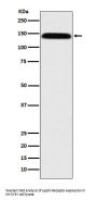 Anti-Leptin Receptor LEPR Rabbit Monoclonal Antibody