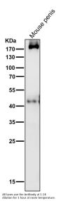 Anti-PDGFR alpha Rabbit Monoclonal Antibody