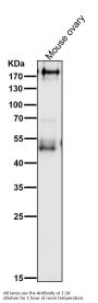 Anti-PDGFR alpha Rabbit Monoclonal Antibody