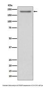 Anti-PDGFR alpha Rabbit Monoclonal Antibody