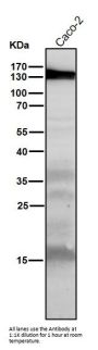 Anti-iNOS NOS2 Rabbit Monoclonal Antibody
