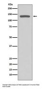 Anti-iNOS NOS2 Rabbit Monoclonal Antibody