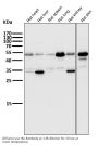 Anti-ATF4 Rabbit Monoclonal Antibody