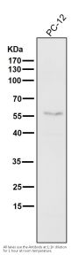 Anti-ATF4 Rabbit Monoclonal Antibody