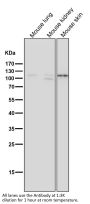 Anti-MCM2 Rabbit Monoclonal Antibody
