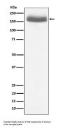Anti-EGF Rabbit Monoclonal Antibody