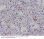 Anti-Survivin BIRC5 Rabbit Monoclonal Antibody