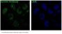 Anti-Survivin BIRC5 Rabbit Monoclonal Antibody