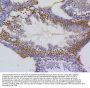 Anti-Survivin Birc5 Rabbit Monoclonal Antibody