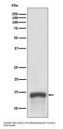 Anti-S100A9 Rabbit Monoclonal Antibody