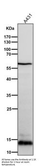 Anti-S100A9 Rabbit Monoclonal Antibody