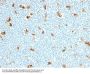 Anti-S100A9 (Macrophage Marker) Monoclonal Antibody