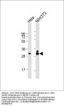 Anti-TPM3 Antibody