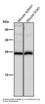 Anti-Interferon gamma IFNG Rabbit Monoclonal Antibody