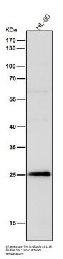 Anti-Interferon gamma IFNG Rabbit Monoclonal Antibody