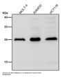 Anti-Interferon gamma IFNG Rabbit Monoclonal Antibody