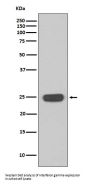 Anti-Interferon gamma IFNG Rabbit Monoclonal Antibody