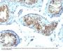 Anti-Interferon gamma (IFNG) Monoclonal Antibody